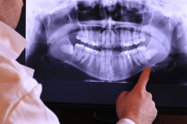 Best Emergency Tooth Extraction in Luray, VA